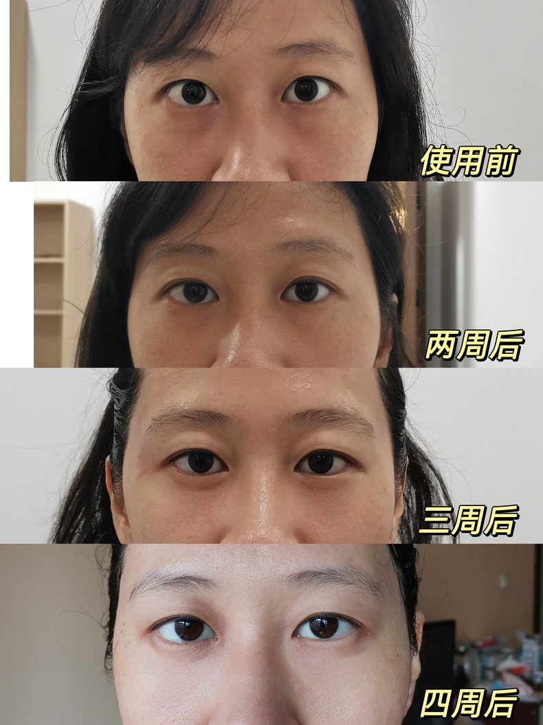 AMIRO觅光淡纹美眼仪ABF206评测觅光美容仪怎么样